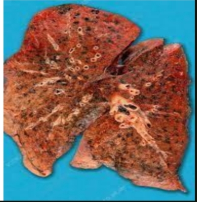 <p>Identify and show the reason </p>