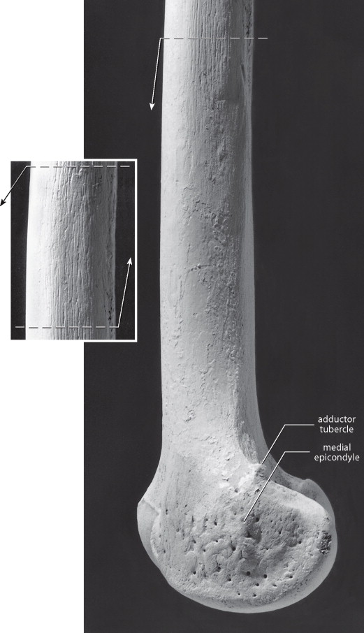 <p>curved extension, more projecting</p>