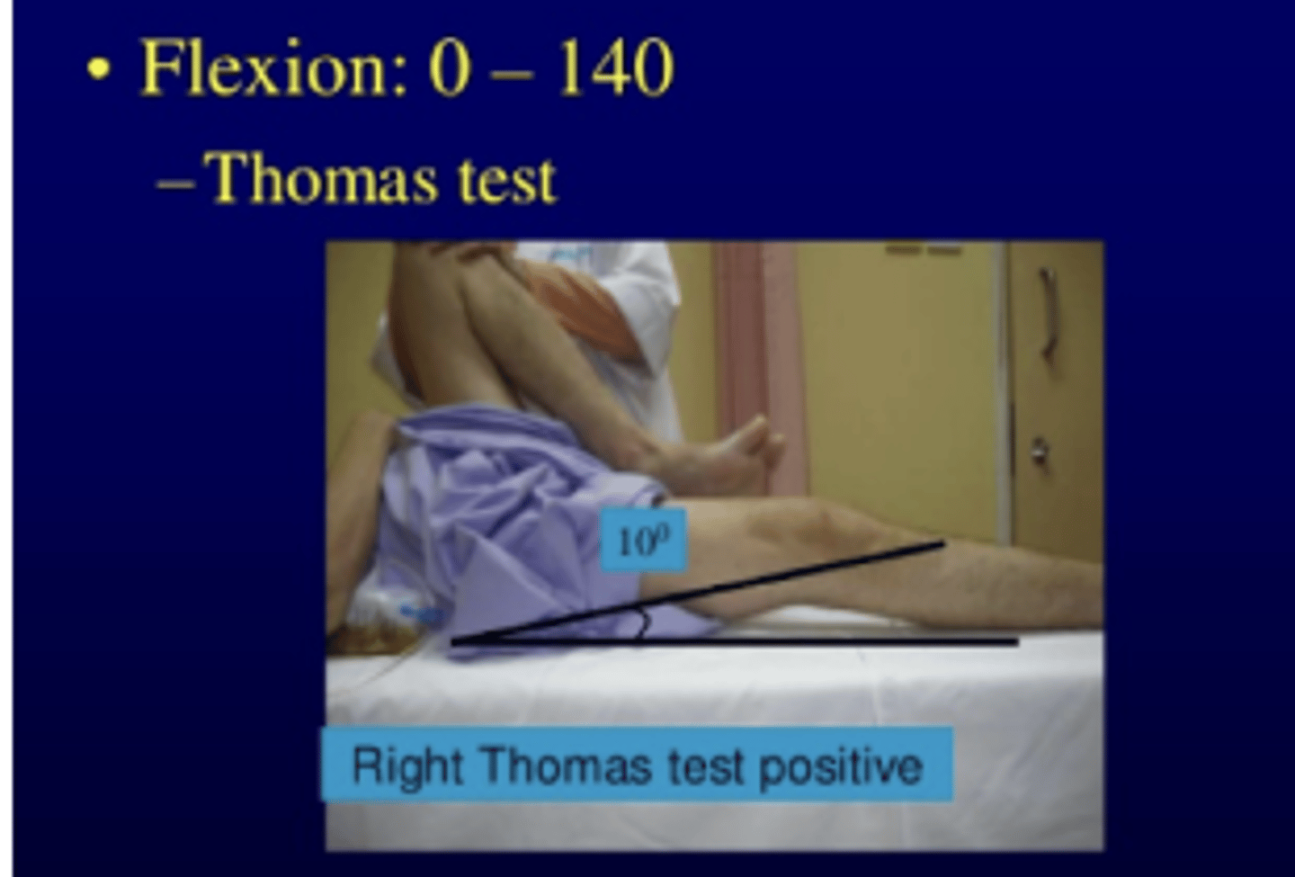 <p>positive= femur lifted 10 degrees off of the bed</p><p>Tests for: Internal Coxa Saltans, tight hip flexors/contracture</p>