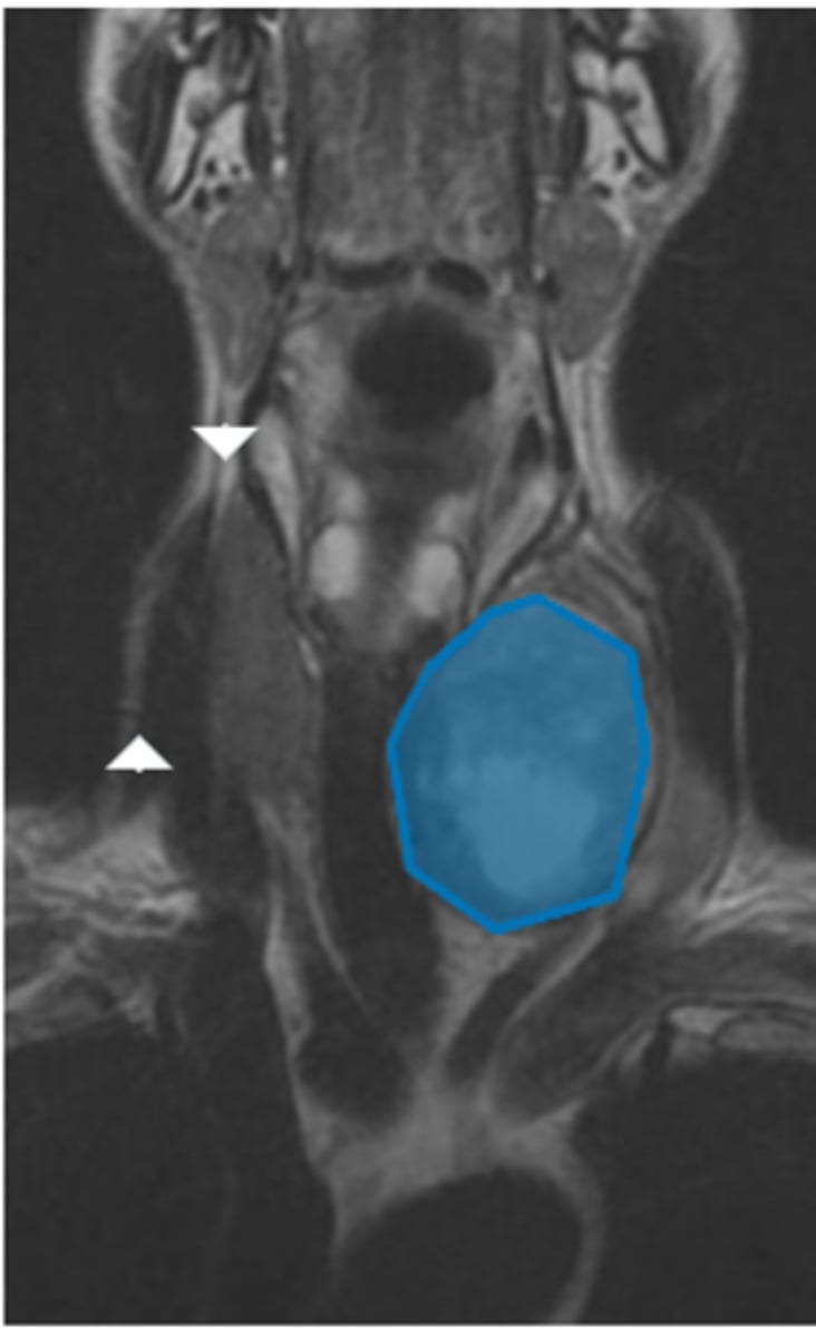 <p>Label pathology in image below</p>
