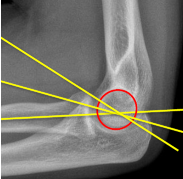 <p>Q what is the name of this measurement? and what is the average + range?</p>