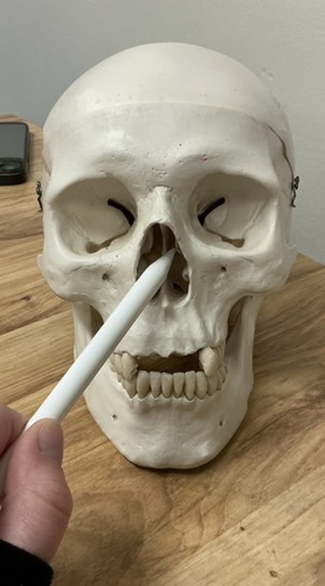 <p>What bone is this?</p>