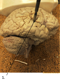 <p>What is the <strong><em>Sulci and Fissures</em></strong> of #1?</p>