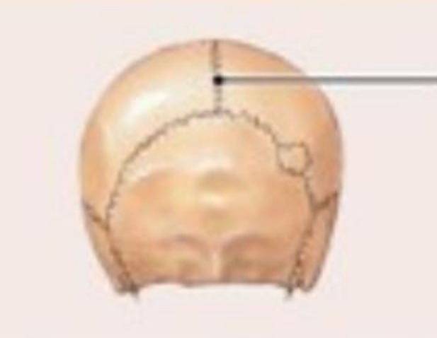 <ul><li><p>Synarthrotic joint (Immovable joint)</p></li><li><p>B/w bones of skull</p></li><li><p>Bones interlocked/bound</p></li></ul>