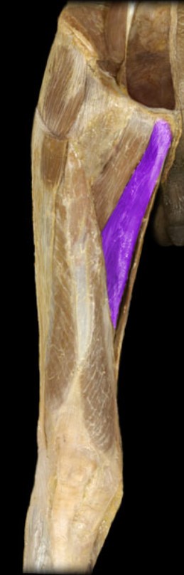 <p>Name the muscle highlighted (two words - all lowercase)</p>