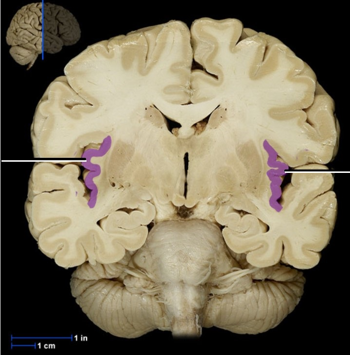 <p><span><span>Insula</span></span></p>