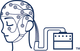 <p>non-invasive neuroimaging technique used to record the electrical activity of the brain</p>