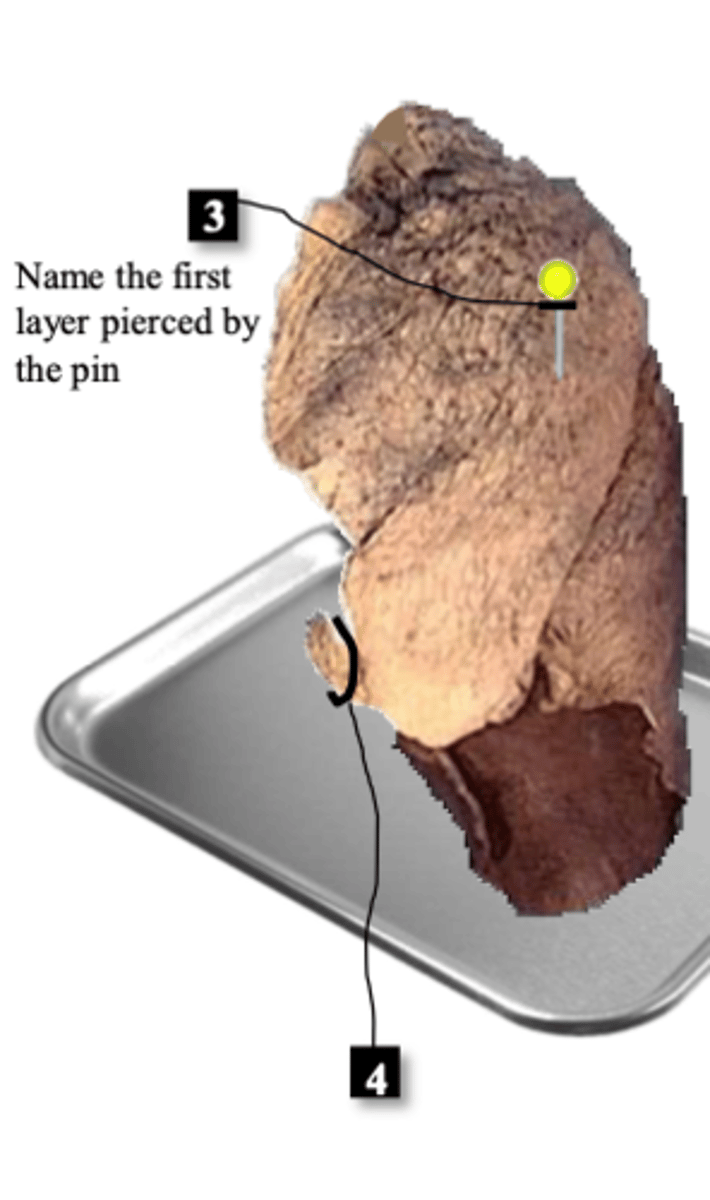 <p>#4</p>