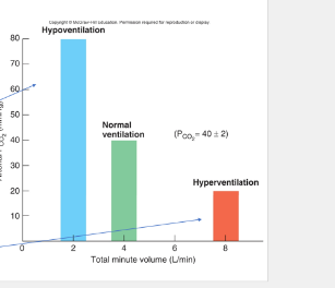 <p><strong>________:</strong> When plasma H+ concentration increases, pH drops below 7.4</p><p>•Arterial H+ concentration increased due to carbon dioxide: <strong><em>respiratory acidosis</em></strong></p>