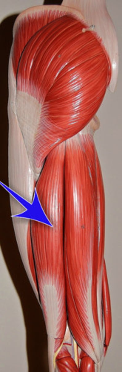 <p>extends thigh and flexes knee, part of the hamstring group</p>