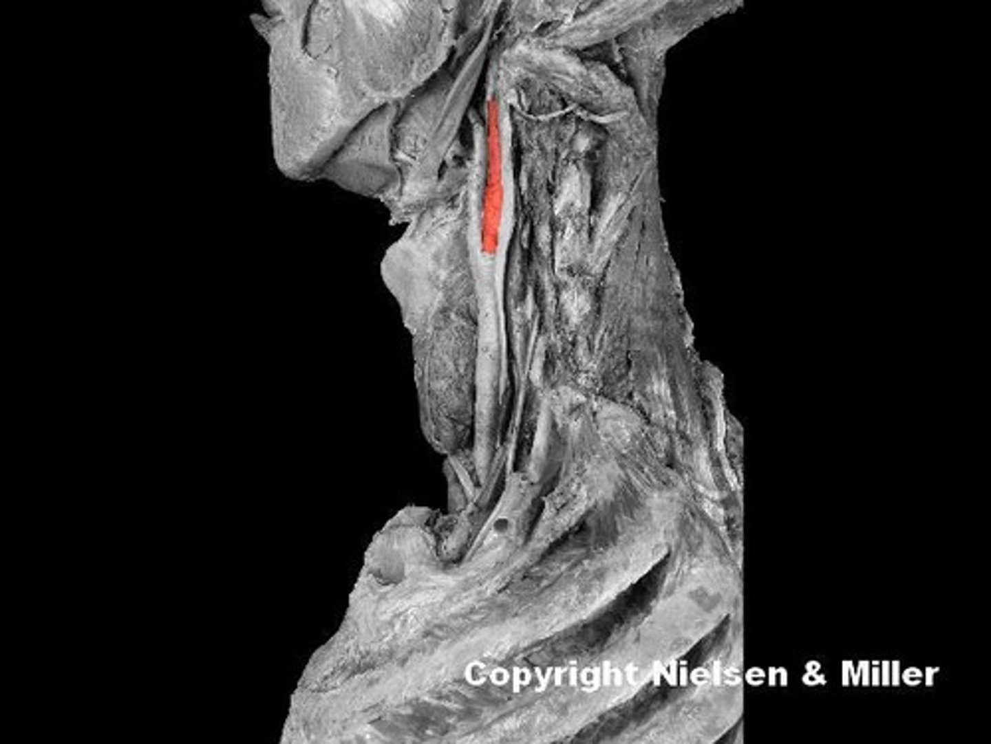 <p>Identify the highlighted branch of the left common carotid artery.</p>