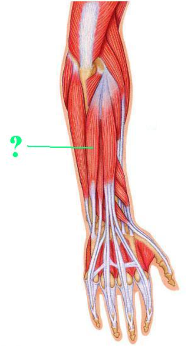 <p><span>Identify the indicated muscle.</span></p>