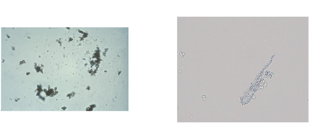 <p><span style="font-family: Arial, sans-serif">Yellow-brown granules microscopically</span></p><p><span style="font-family: Arial, sans-serif">pH usually greater than 5.5</span></p>