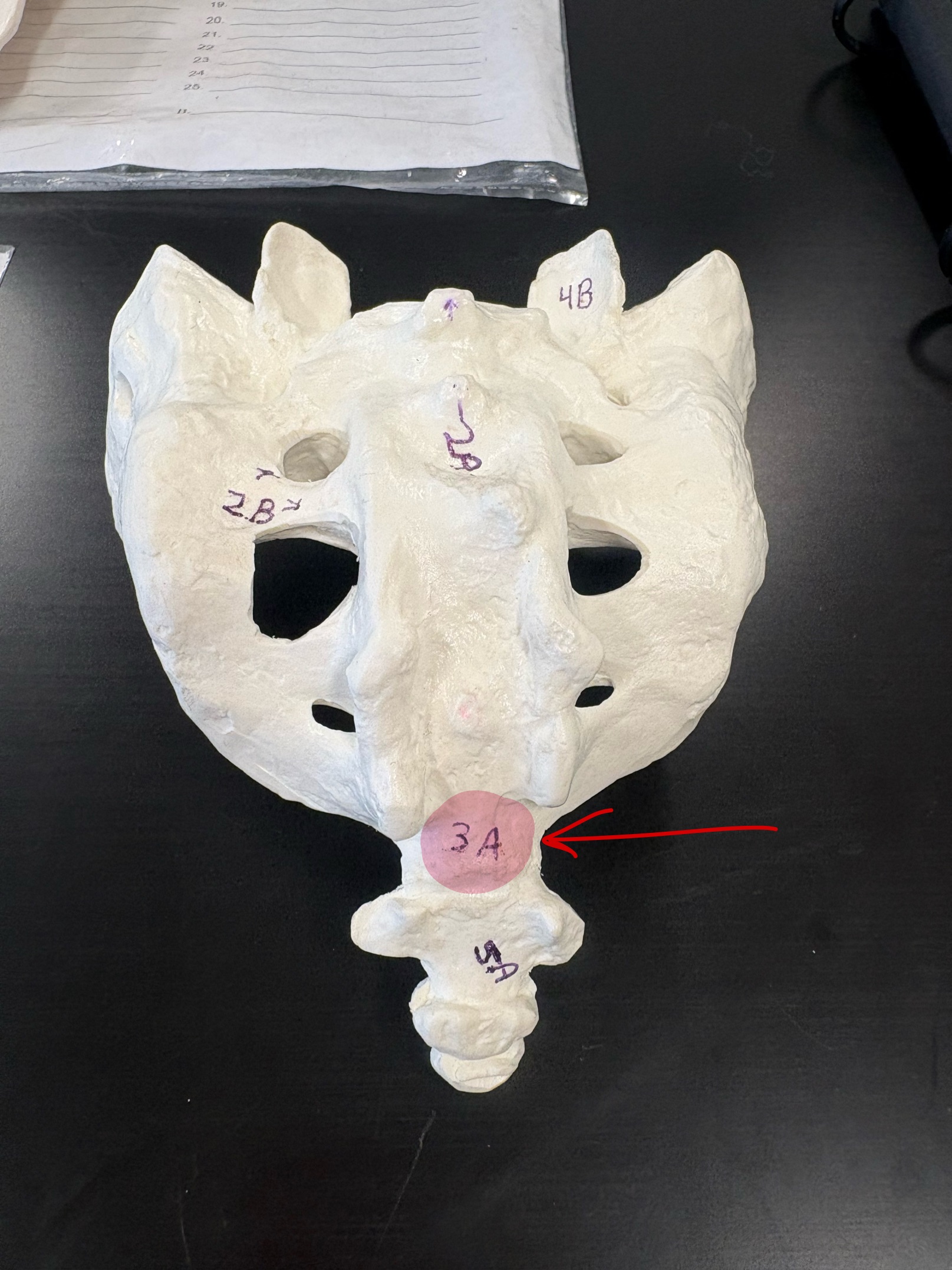 <p>Name this structure</p>