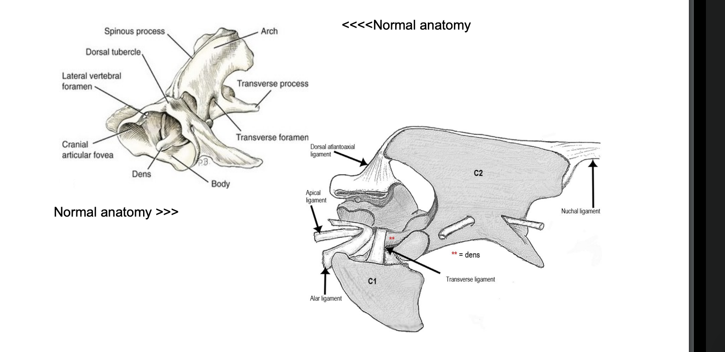 <p>Diagnosis o Radiographs and MRI o CT scan • Treatment o Conservative: Rest and neck brace o Surgery: Fixation e.g. with pins or screws with bone cement (Polymethylmethacrylate, PMMA) • Prognosis o Depends on severity of neurological deficits o High rate of complications with surgery o 0-30% complication rate, 5-10% in more recent publications</p>