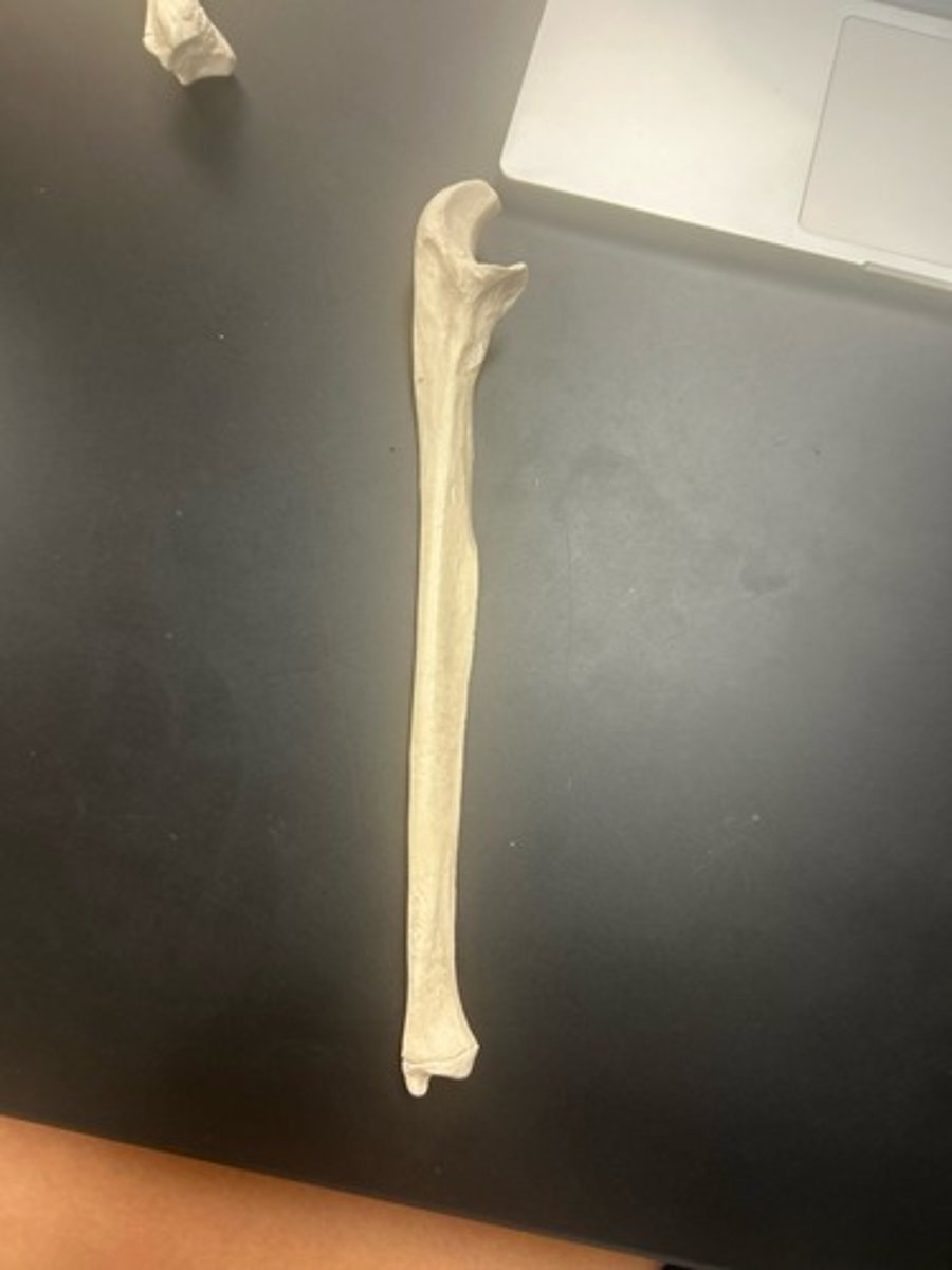 <p>name the bone</p>