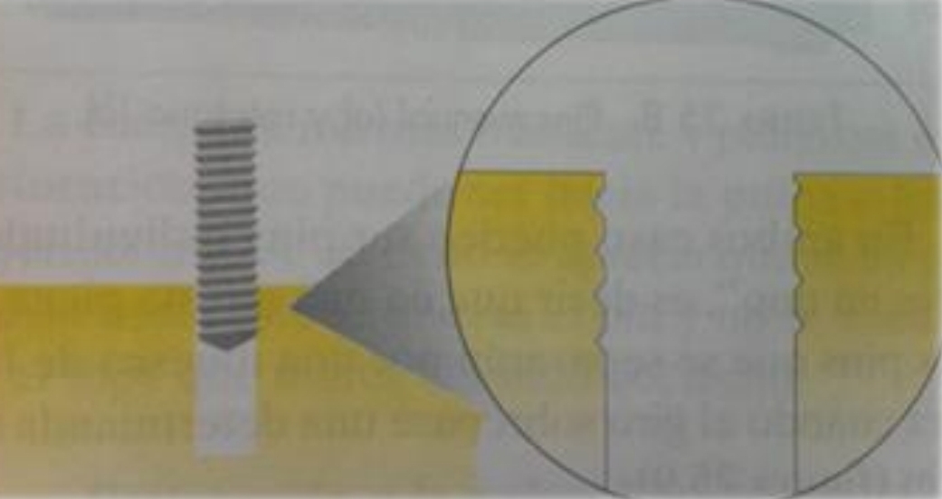 <p>Slot in dentin with 0.1 mm diameter, lower than pin. Pin works it’s own thread into slot wall.</p>