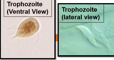 <p>Squished and clear with 8 flagella</p>