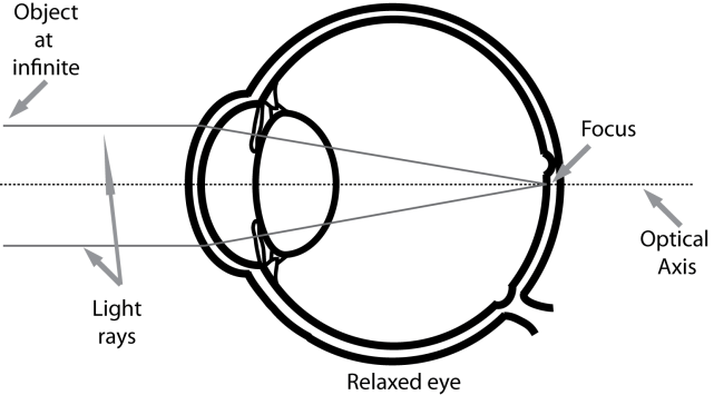 <p>normal, clear vision that occurs when the eye’s optical components are properly aligned and focused</p>