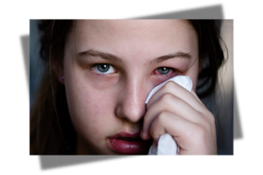 <p>slept with contacts in</p>