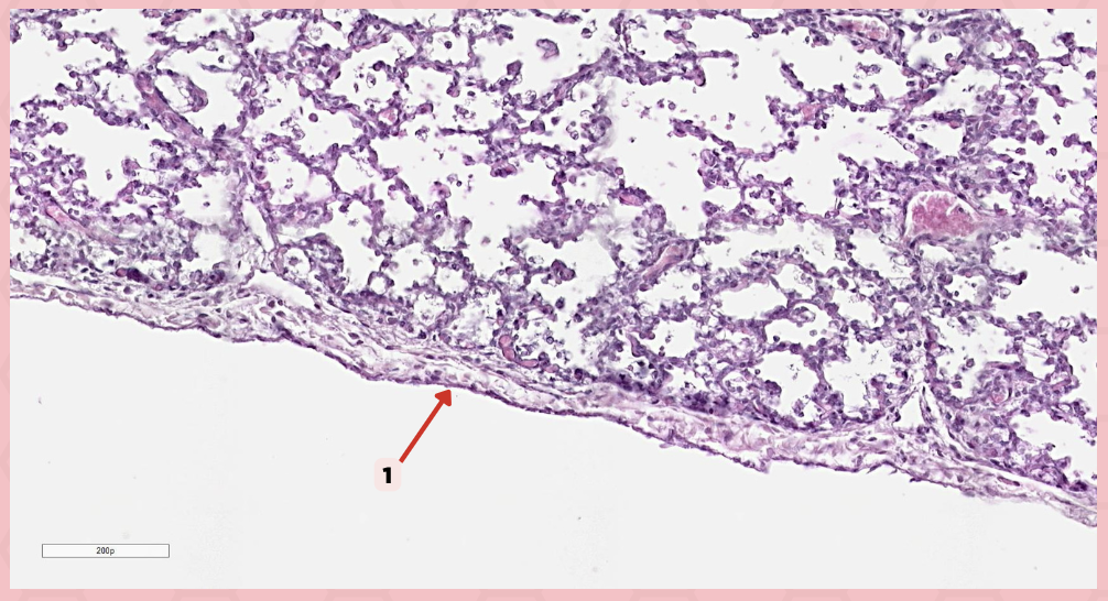 <p>Identify the structure labeled as 1.</p>