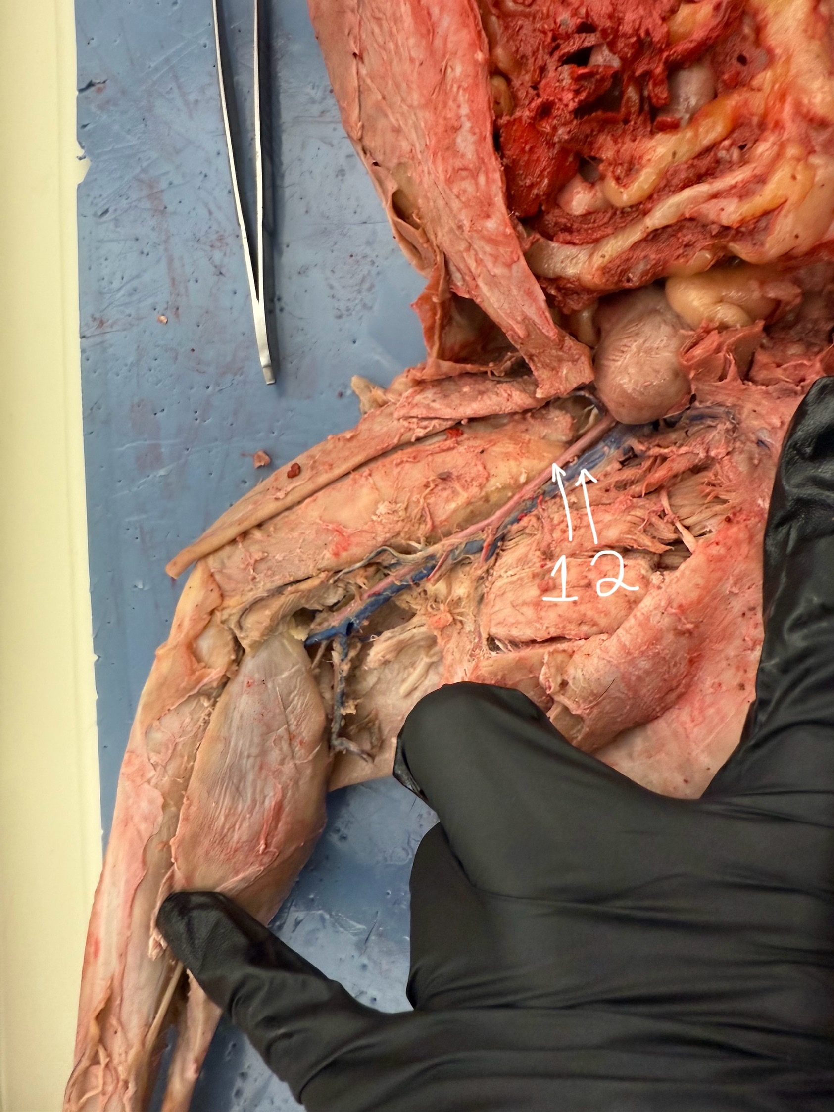 <p>What is the pointer at?</p>