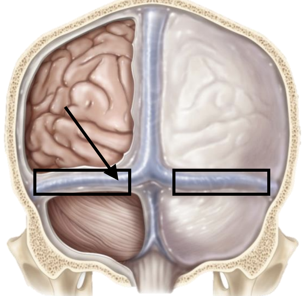 <p>Name the structure</p>