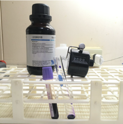 <p>What is the dilution used in this test?</p>