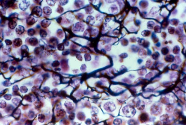 <p>1. reasembles areolar tissue BUT THE ONLY FIBERS PRESENT in its matrix are RETICULAR FIBERS which hold many free cells<br>-found in the bone marrow, spleen, and lymph nodes (all have many free blood cells outside their capillaries)</p>