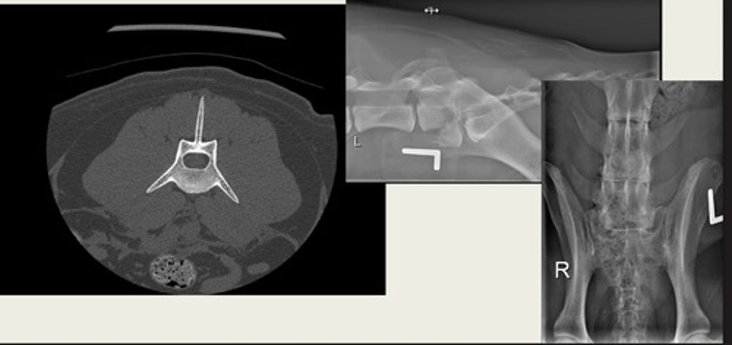 <p>is the left image a CT or MRI?</p>