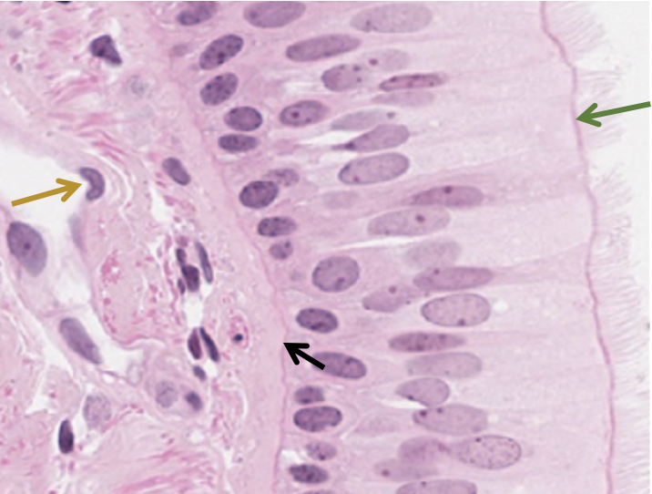 <p>Classify the epithelium ID the structure at the black arrow ID the cell at the gold arrow ID the organelle at the green arrow</p>
