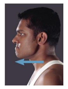 <p>Lateral pterygoid mm.</p>