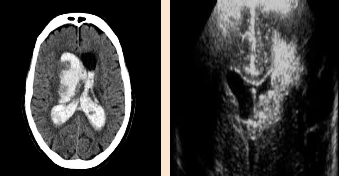 <p>What pathology is being shown?</p>