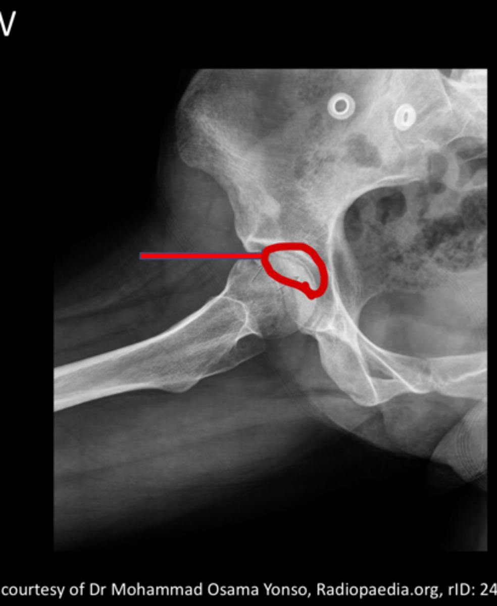 <p>what is this showing, what is it indicative of?</p>