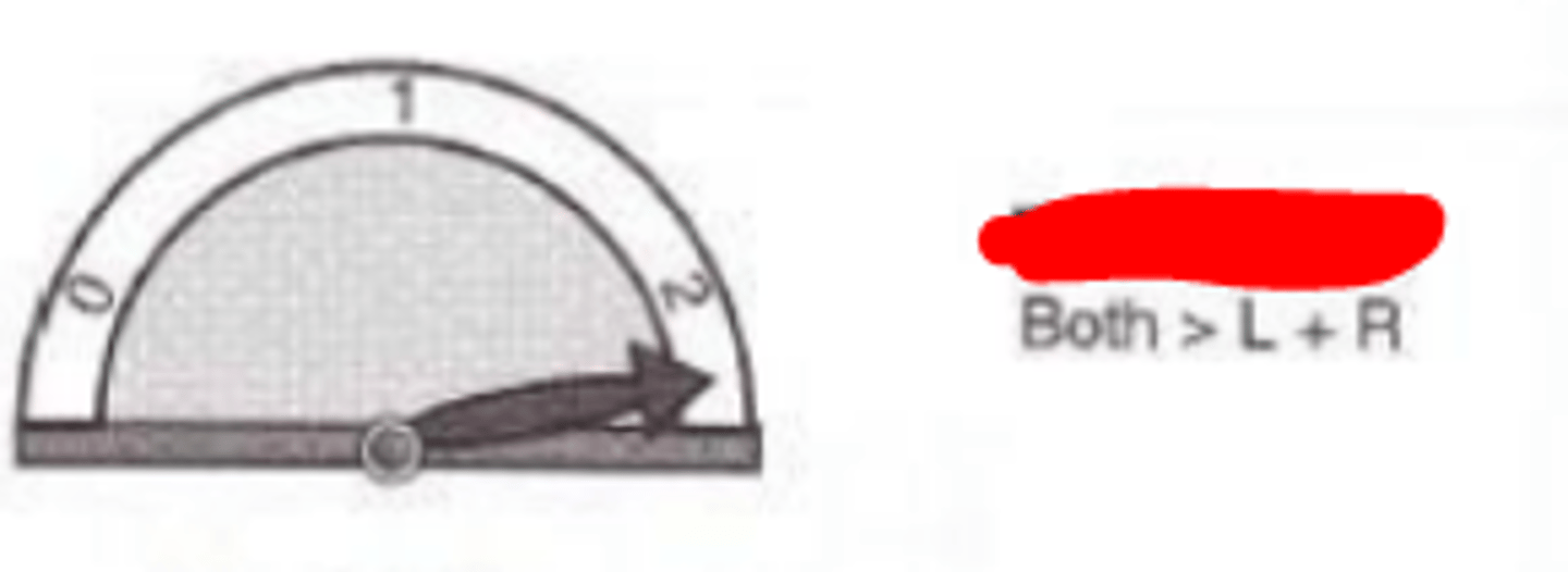 <p>degree of binocular summation where visual performance is better with both eyes than the sum of each eye.</p>