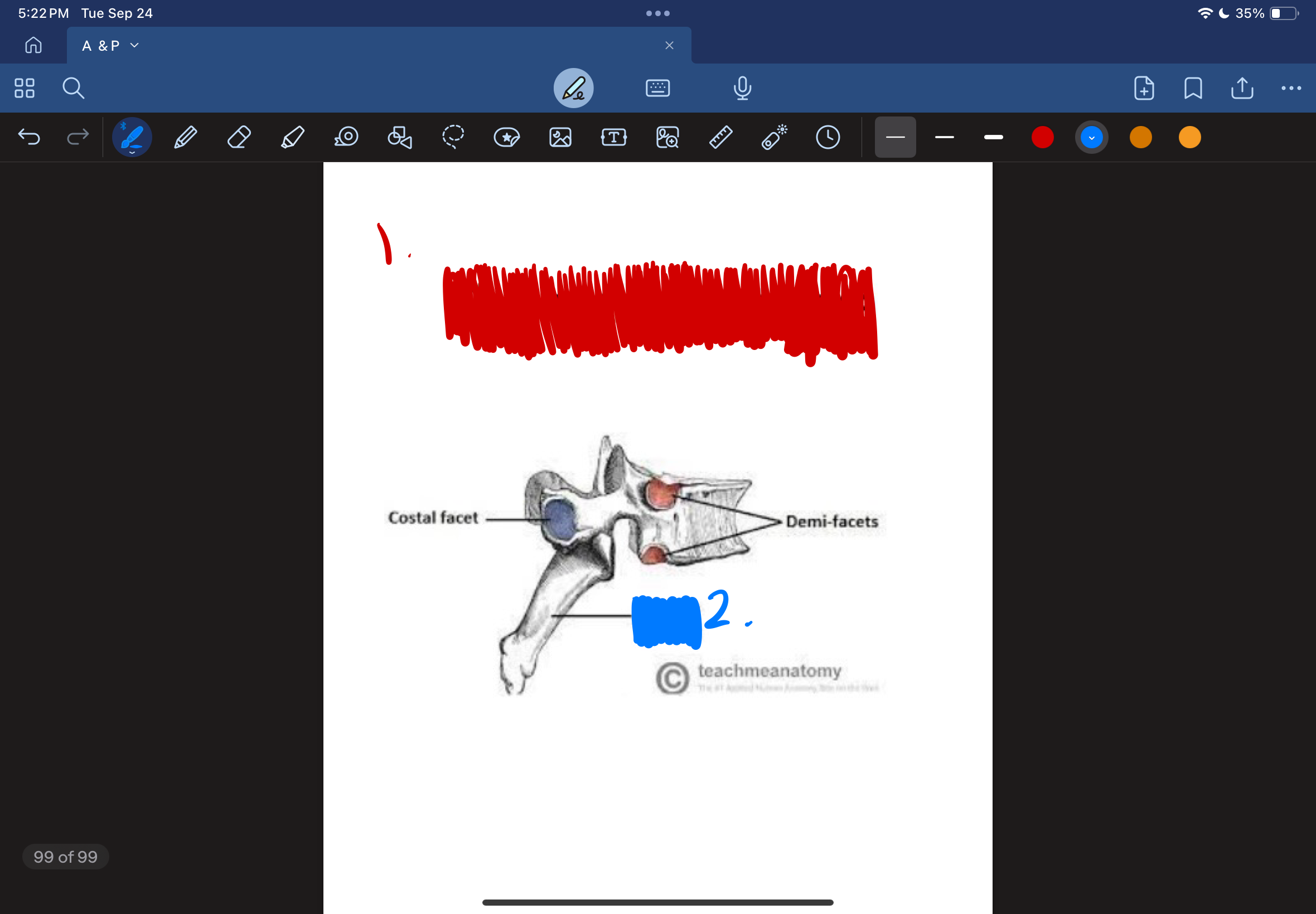 <ol><li><p>(Red)</p></li></ol>