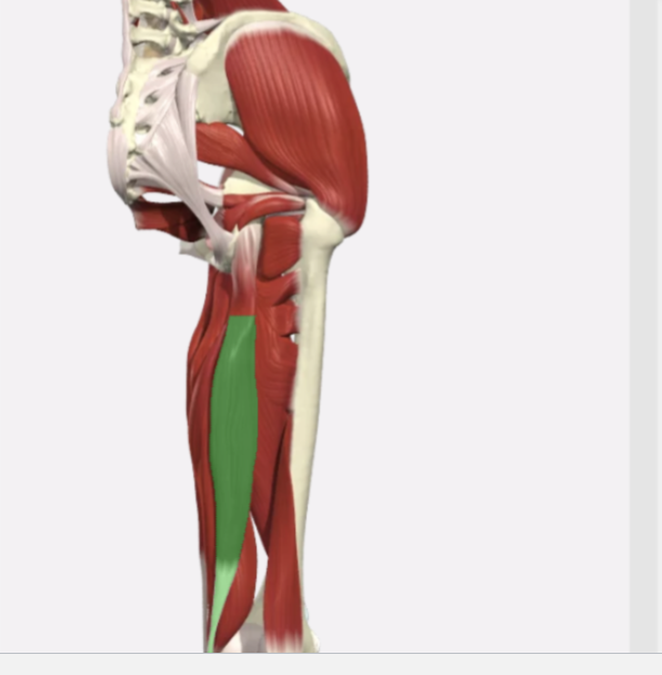 <p>Semitendinosus</p>