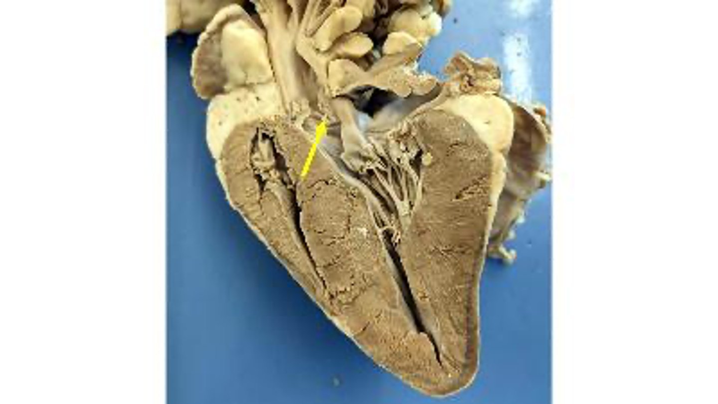 <p>Name the membranous structure</p>