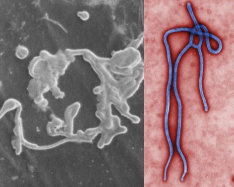 <p>Genus: Ebolavirus</p>