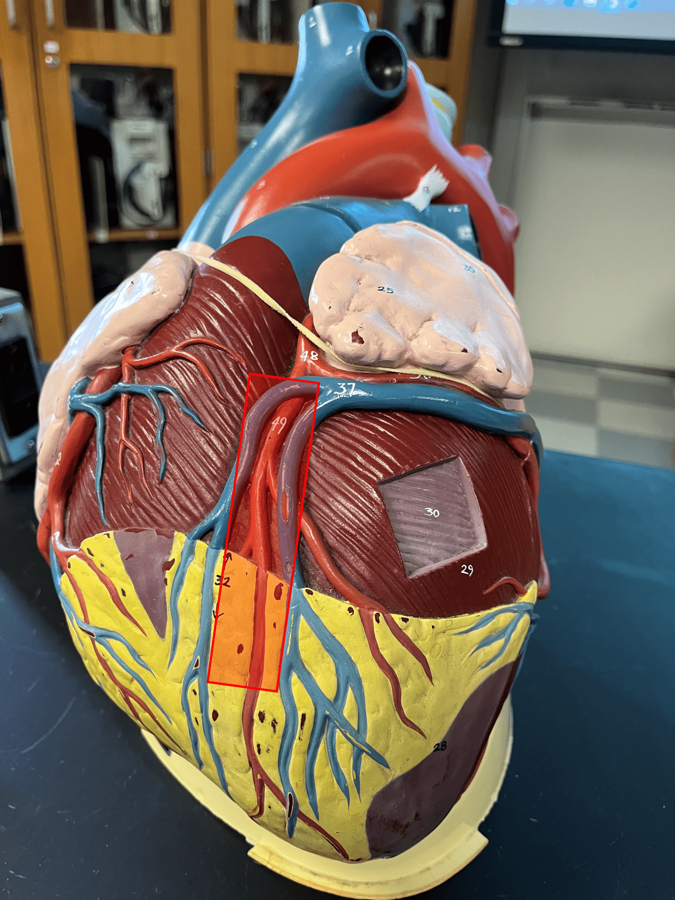 • Sulcus dividing the right and left ventricles of the heart on the anterior side of the heart.

• Contains coronary blood vessels.
