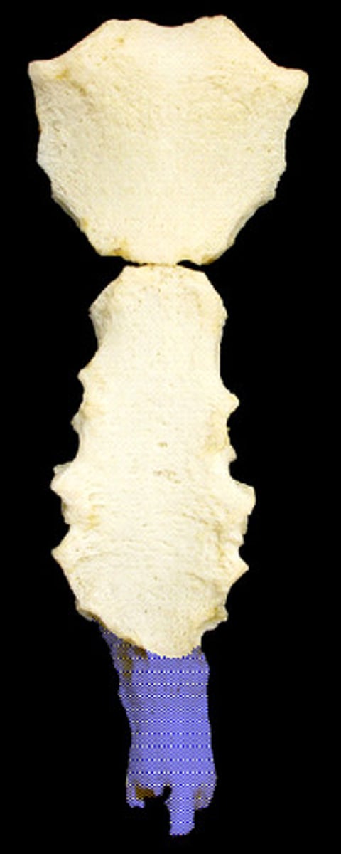 <p>end bone of the sternum</p>