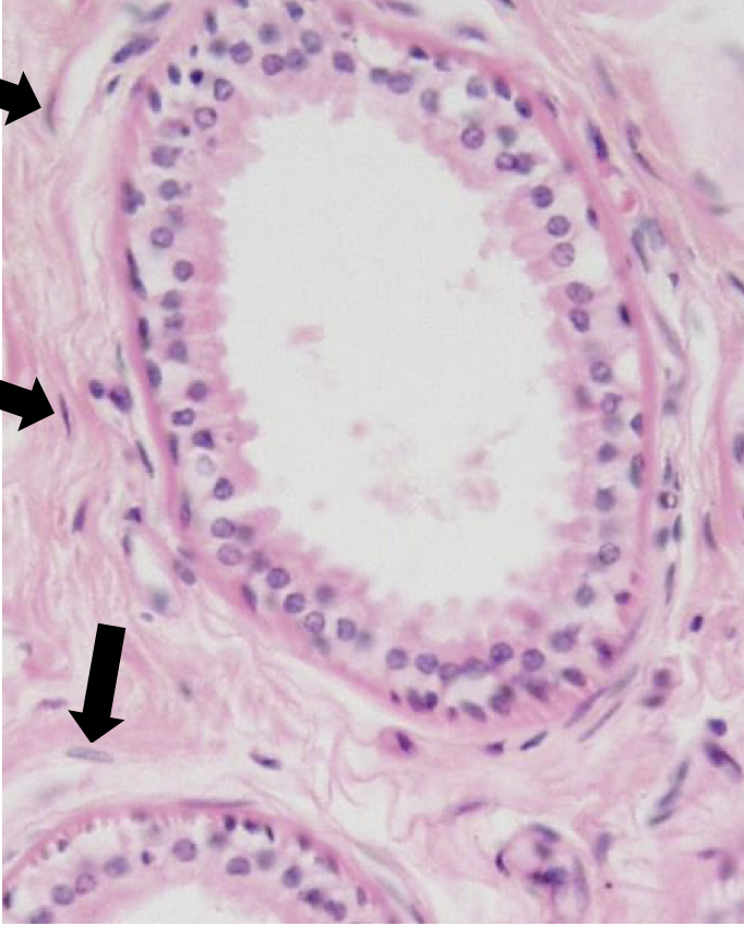 <p>What cell is the arrow pointing at?</p>