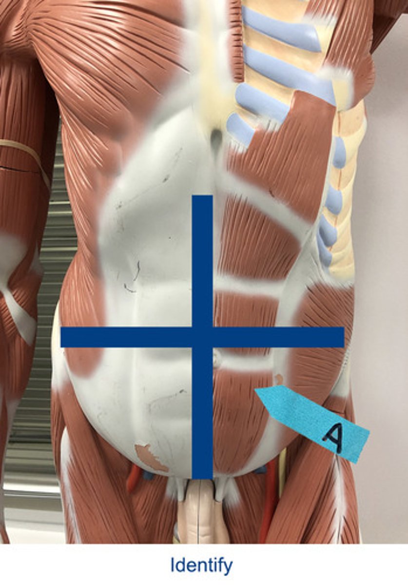 <p>Identify the area indicated by the arrow.</p>
