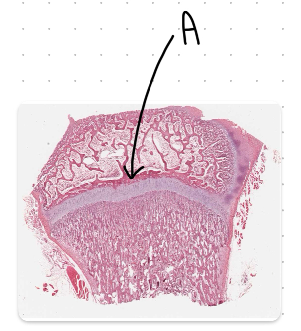 <p>What is the structure labeled A in this image?</p>