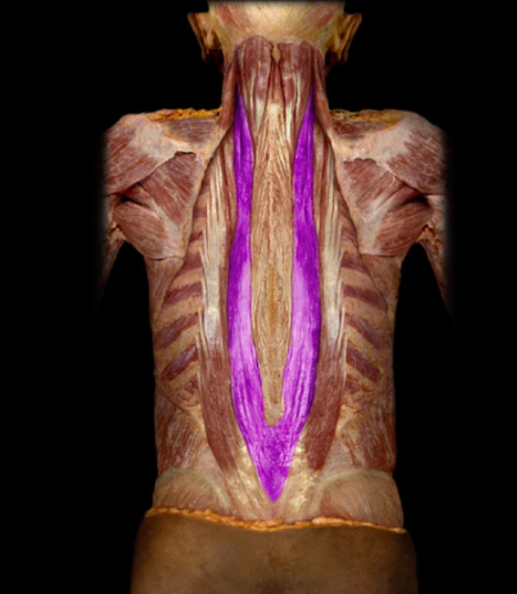 <p>composed of:</p><p>longissimus thoracis M</p><p>longissimus cervicis M</p><p>longissimus capitis M</p>