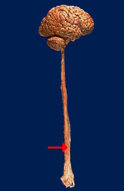 <p>Label this specific structure</p>