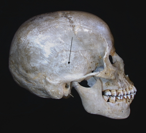 name the bone 