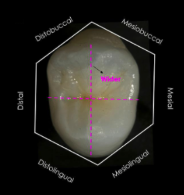 <p>buccolingually than mesiodistally</p>
