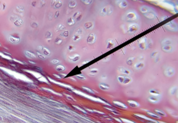 <p>what kind of cartilage is this</p>