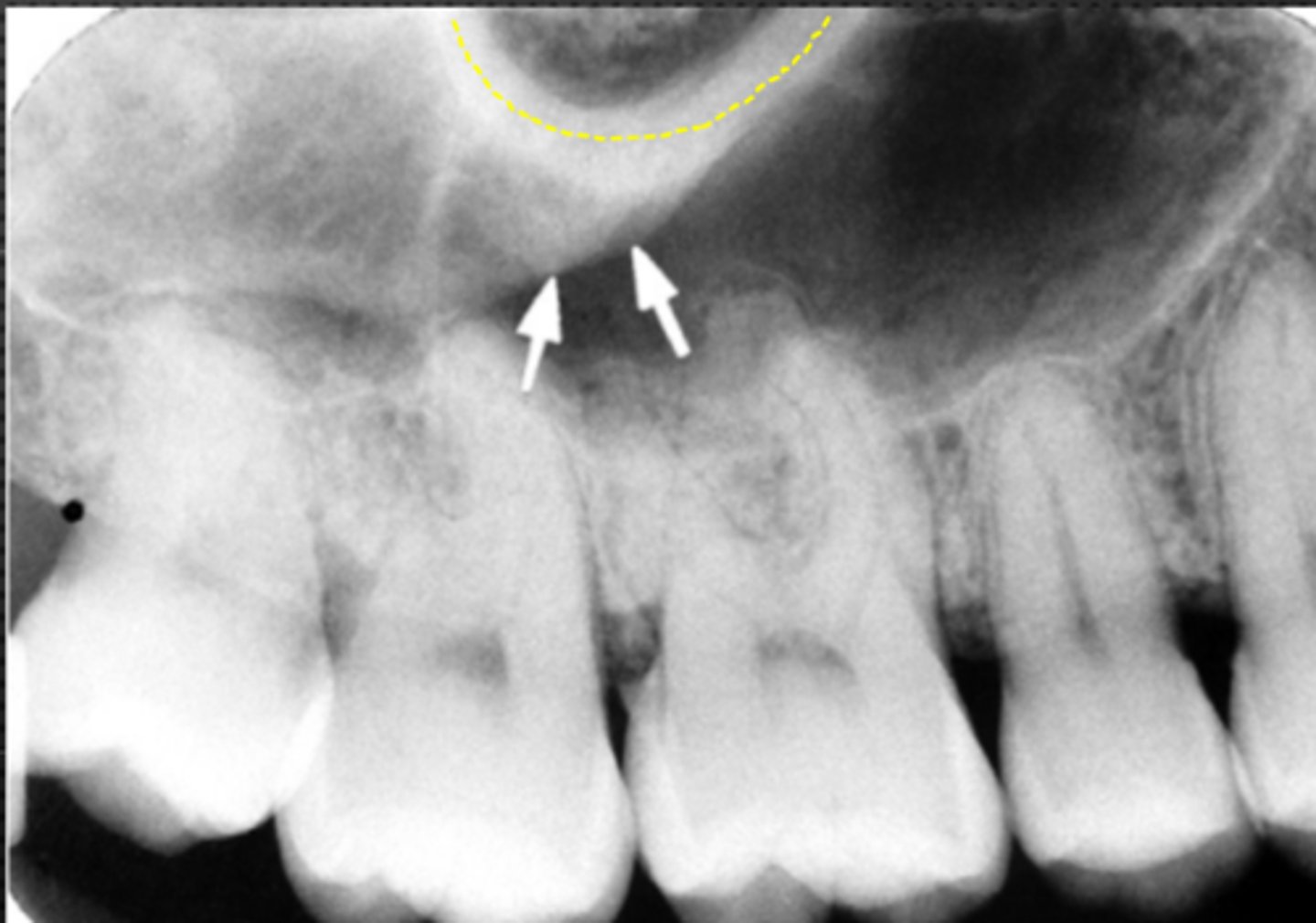 <p>Identify the two structures</p>